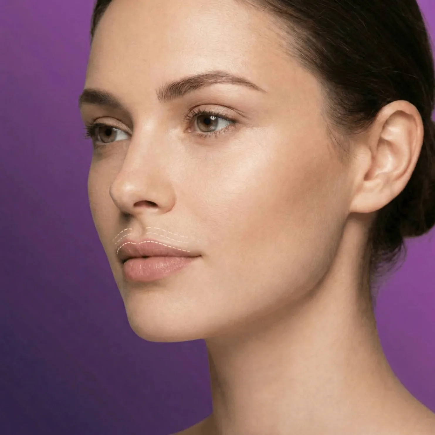 Lip Flip Behandlung – Oberlippe definieren
